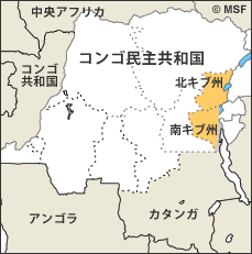 コンゴ民主共和国