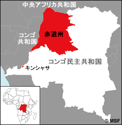 コンゴ民主共和国