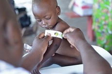 「命のうでわ」で診断を急げ　コロナ流行の中、栄養失調から子どもの命を守る