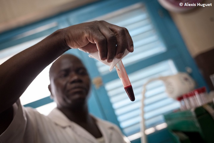 MSFが支援する病院で、ヘビにかまれた患者の血液凝固検査をする看護師。（中央アフリカ共和国）