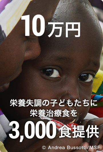 10万円 栄養失調の子どもたちに栄養治療食を3,000食提供 ©Andrea Bussotti/MSF
