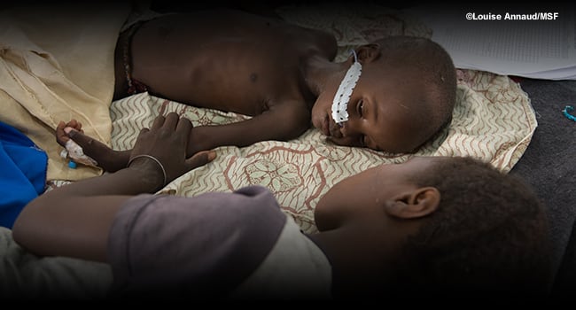 マラリア、栄養失調を併発している子どものイメージ写真