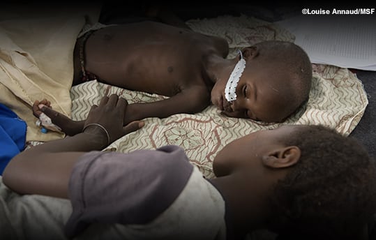 マラリア、栄養失調を併発している子どものイメージ写真