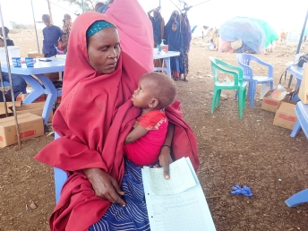 ソマリアの国内避難民キャンプで重度の栄養失調と診断された<br> 1歳半の娘を抱く母親　©  Marian Isak/MSF
