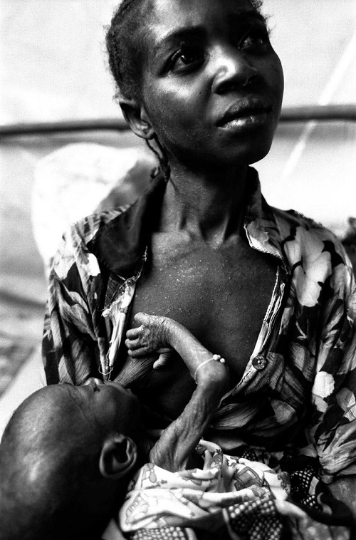 飢餓で苦しんでいた23歳の母親と8ヶ月の赤ん坊が郊外の村からトラックで病院に運ばれてきた＝2002年、アンゴラ・バイルンドで渋谷敦志撮影