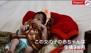 1700グラムの赤ちゃんを助けたい 栄養失調の母は母乳も出ず 活動ニュース 国境なき医師団日本