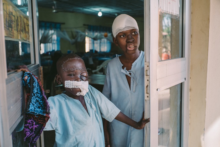 再建手術を受けたウマル君（左）と、15歳のアダムさん。ナイジェリア・ソトコ州の水がん病院で © Claire Jeantet - Fabrice Caterini/INEDIZ