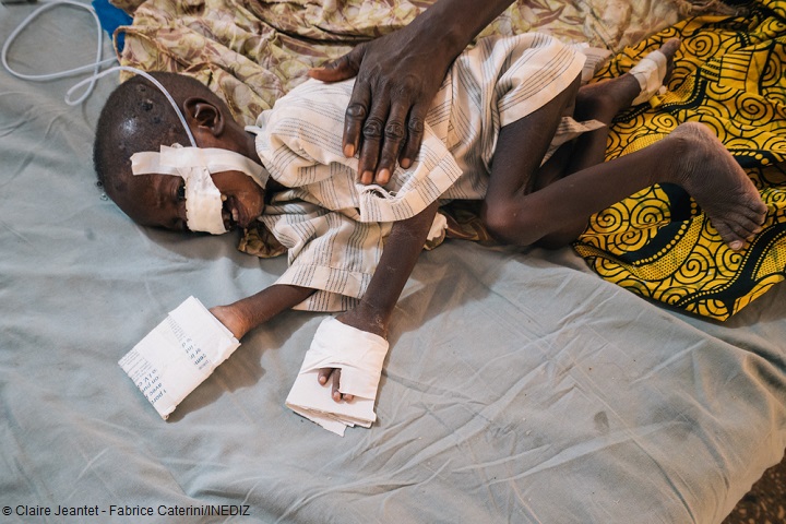 MSFのソコト水がん病院で治療を受けるスフュアヌちゃん