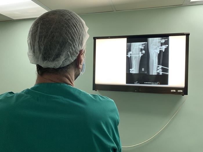 ユスリさんのレントゲン写真をみるMSFの外科医。© Jacob Burns/MSF