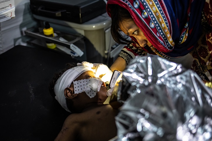 地雷で大けがをした子ども。頭蓋骨、片方の腕と顔に地雷の破片が残り、アデンに移送された　© Agnes Varraine-Leca/MSF