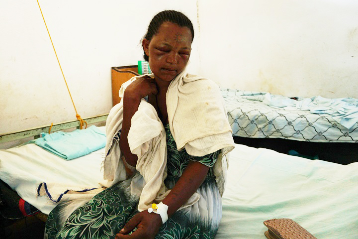 毒ヘビにかまれMSFの治療を受けるウォーキーさん　© Susanne Doettling/MSF