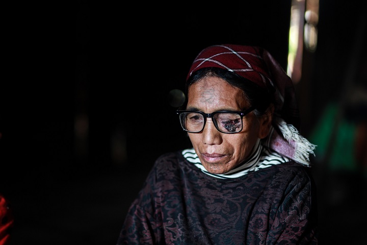 10年も目を患っていたチュンさんは、最近ようやく治療を受け始めた　© Scott Hamilton/MSF