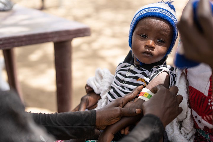 MSFスタッフから、栄養失調状態を確かめる「命のうでわ」を腕に巻かれる子ども © Juan Haro

