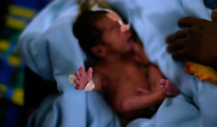 ゴヤルマラ病院の新生児集中治療室で治療を受ける赤ちゃん　© Nitin George/MSF
