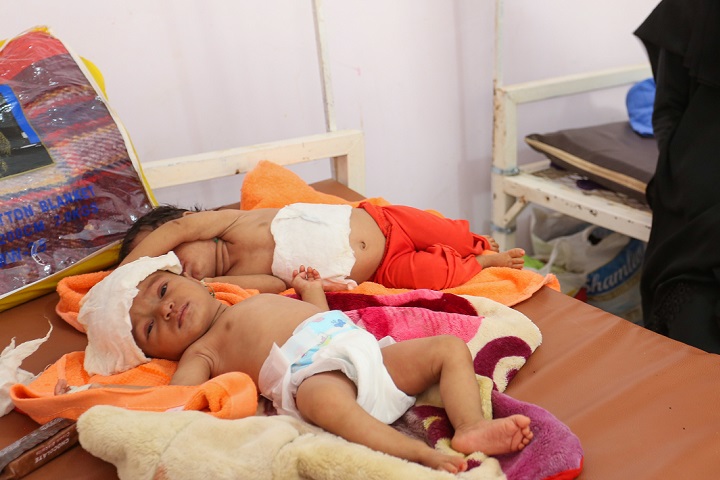 アブスの病院ではしかの治療を受けるブシュラちゃんとバシャイェルちゃん　© Al Hareth Al Maqaleh/MSF