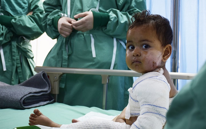 熱湯の上に転んでしまったブスラちゃん　© Candida Lobes/MSF