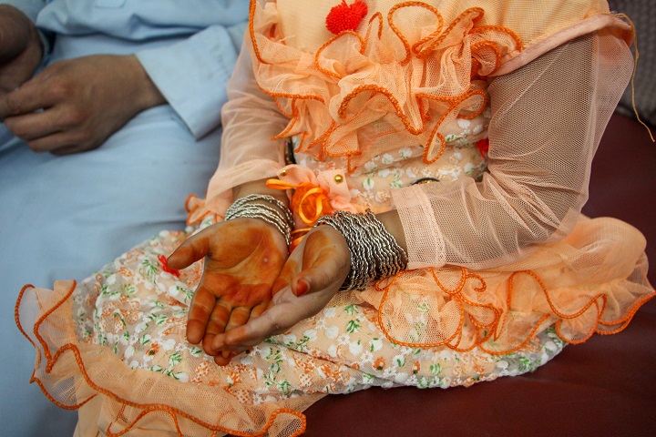ヘナをしたアイーシャちゃんの手に、刺された傷が見える　© Nasir Ghafoor/MSF