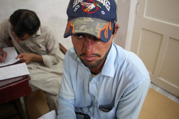 治療が済むまで結婚を延期したシャンバズさん　© Nasir Ghafoor/MSF