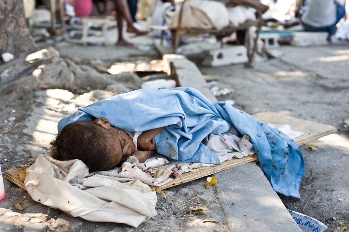 地震で負傷し治療を待つ子ども=2010年1月　© Julie Remy/MSF