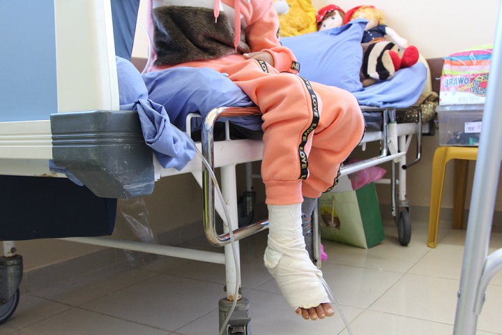 大けがをした足は回復に向かっている © Candida Lobes/MSF