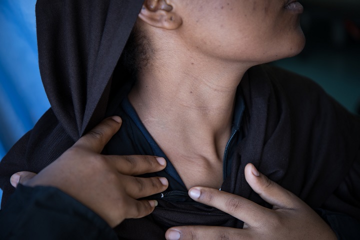 リビアを目指す過程で、レイプに遭い、首にナイフを突きつけられるなどの暴力に遭った女性 © Aurelie Baumel/MSF<br>