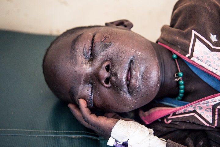 毒ヘビにかまれて病院で横たわるケニアの少年　© Paul Odongo/MSF