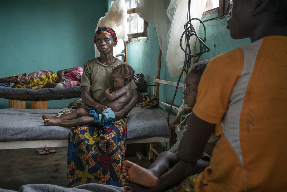 そのドドちゃんを抱く母親のワネア・マベレさん（40歳）。トドちゃんは、目への感染が進行しており、視力の回復は困難と見られている。© MSF/Caroline Thirion