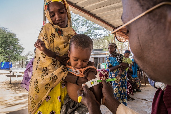 身長や体重の測定よりも短時間で検査ができる　© Juan Carlos Tomasi/MSF