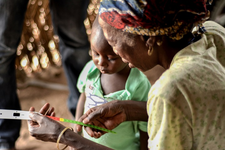 「命のうでわ」の使い方を学ぶニジェールの女性。栄養失調の深刻度が赤・黄・緑の色で分かる＝2018年　© MSF/Elise Mertens