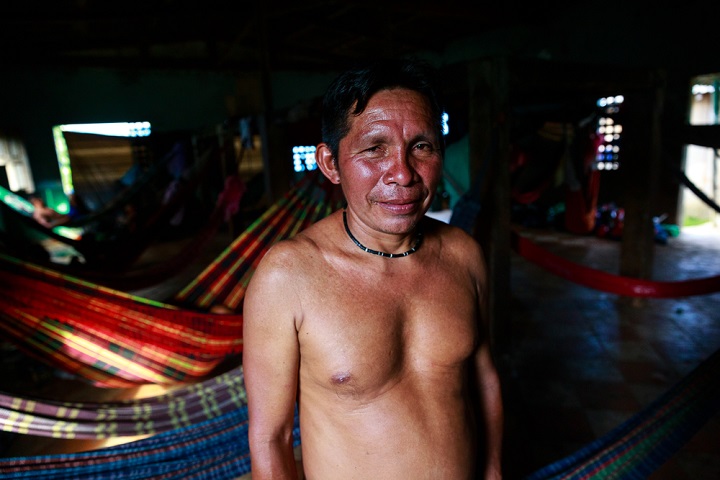 先住民ヤノマミ族の指導者ヴィウマル・ダ・シウヴァ・マトスさん　© DiegoBaravelli/MSF