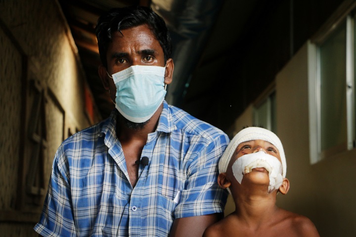 交通事故に遭った息子の看病をするロヒンギャ難民のアブさん　© Hasnat Sohan/MSF　