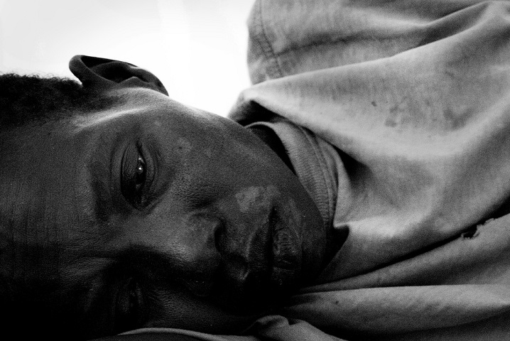 ヤンビオの病院でアフリカ睡眠病の治療を受ける男性＝2006年　© Misha Friedman