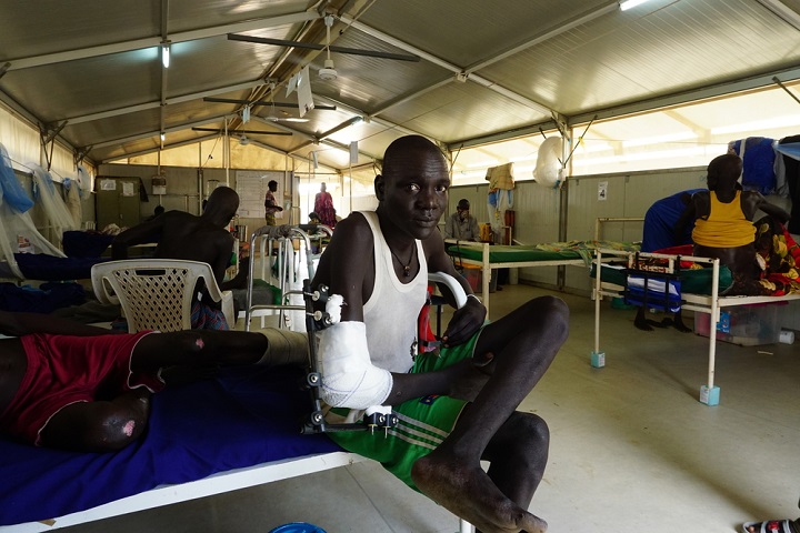 南スーダン・ピボールでの戦闘で負傷し、治療を受けた29歳の男性　© Caterina Spissu/MSF