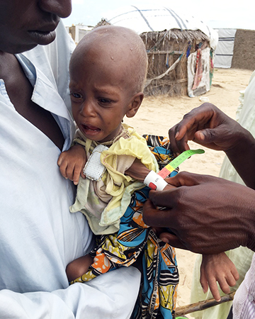「命のうでわ」で子どもの栄養状態を診断　© MSF