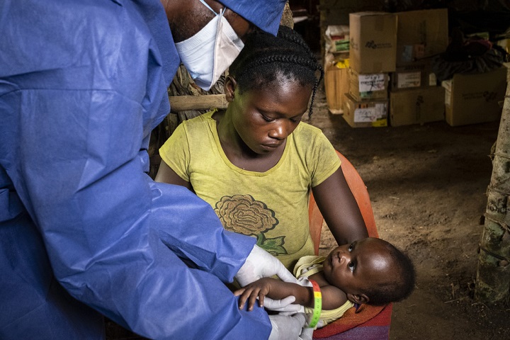 子どもの栄養失調など、エボラのみならず地域のさまざまな医療ニーズに対応している　© Caroline Thirion/MSF