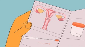子宮頸がん検査の検体を自己採取　© Carrie Hawks/MSF
