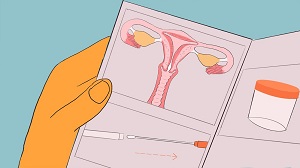子宮頸がん検査の検体を自己採取 © Carrie Hawks/MSF