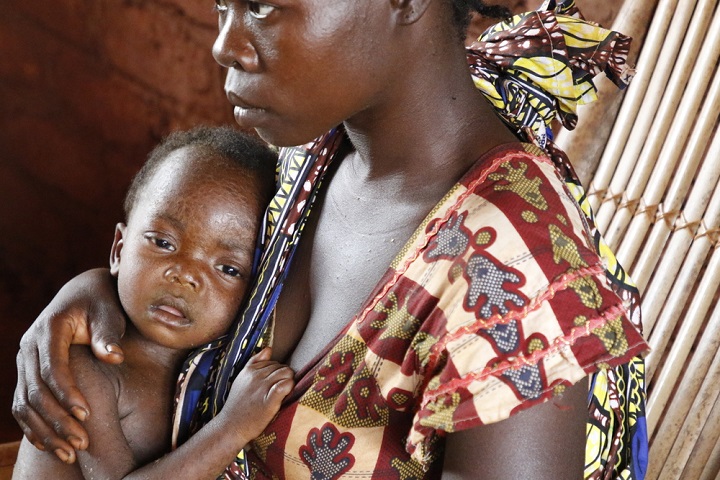 はしかを患うコンゴの子ども　呼吸困難や皮膚の発疹の症状が出ており、総合病院へ移送される　© Franck Ngonga/MSF