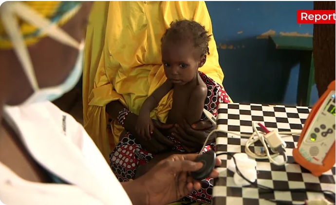 【動画】栄養失調、マラリアも……急増する患者、国境を越えて2つの国の幼い命を救う
