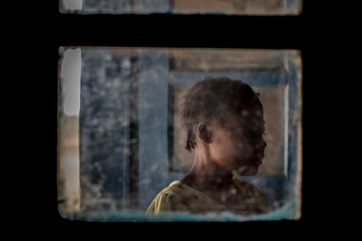 性暴力を受けた女性（28歳）　© Candida Lobes/MSF