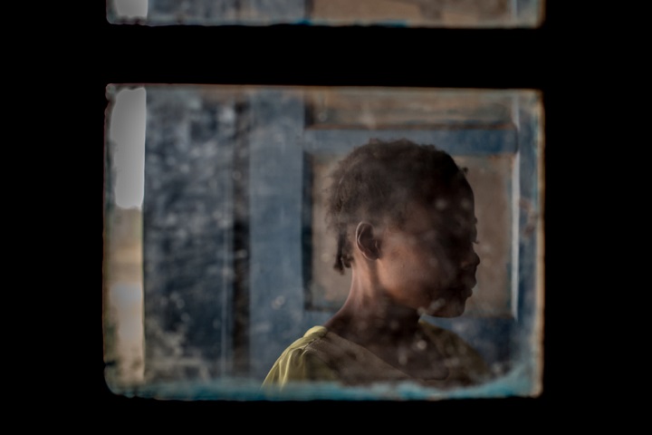 性暴力を受けた女性(28歳) © Candida Lobes/MSF