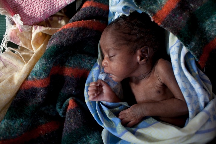南スーダンの遠隔地では、超未熟児の赤ちゃんが生き延びられる可能性は高くない。
2012年に南スーダンのランキエンで生まれた未熟児の赤ちゃん　© Brendan Bannon