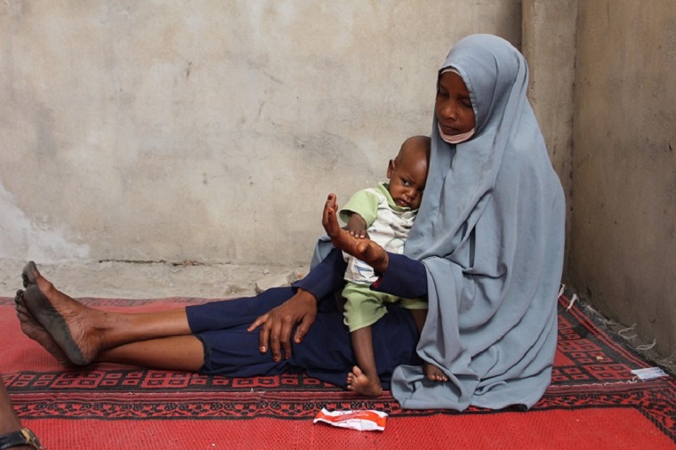 1歳のわが子を連れてMSFの栄養治療センターを受診した母親　© Claudia Blume/MSF