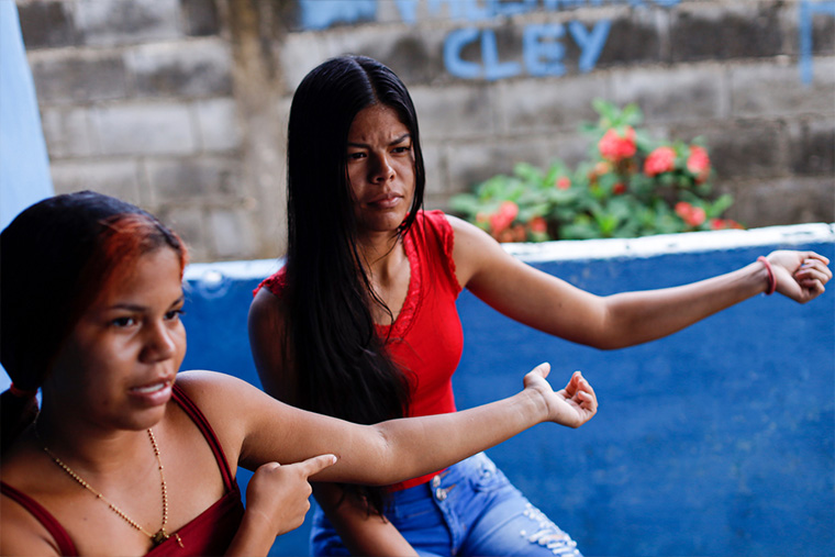 病院で皮下インプラントを埋め込んだ腕を見せる女性たち　Ⓒ Jesus Vargas