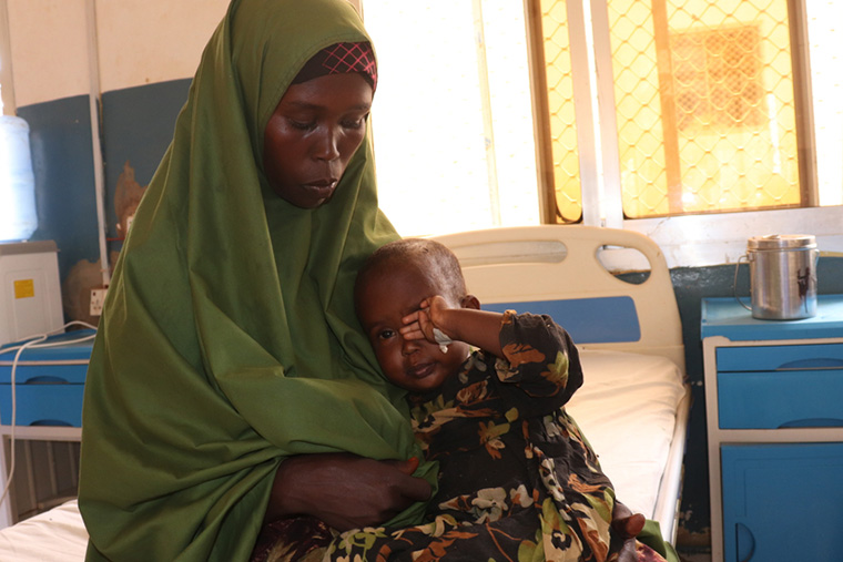 ベイ地域病院のはしか隔離病棟で、病気の娘を抱く母親のアベイさん Ⓒ Dahir Abdullahi/MSF