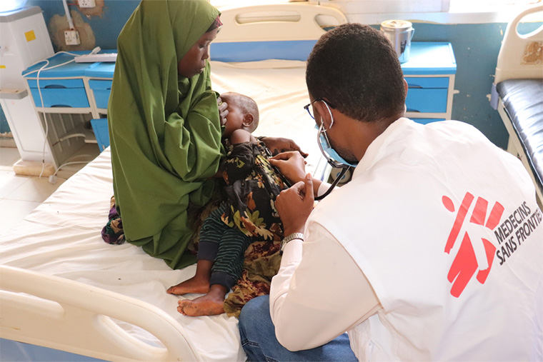 MSFの医師がはしか患者の診察を行う。はしかは栄養失調を引き起こす可能性があり、栄養失調の子どもははしかに感染しやすくなる　Ⓒ Dahir Abdullahi/MSF