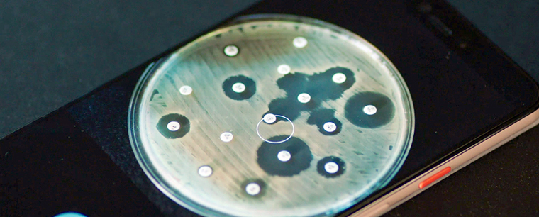 Antibiogo が阻止円直径を測定し、解釈もアプリが行う　© MSF