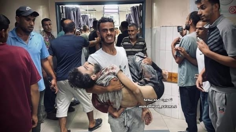 イスラエル軍の攻撃で傷つき、ナセル病院に運び込まれたアブドッラー。この写真は彼の家族の同意と、公表してほしいという明確な要請に基づいて掲載している＝2025年7月3日　© Mohammad Salama