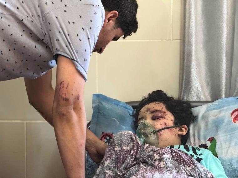 ガザ地区北部の自宅で空爆に巻き込まれた8歳の男の子(右)。MSFの医師でもある父親がそばで見守っている=2025年6月28日 Ⓒ Nour Alsaqqa/MSF