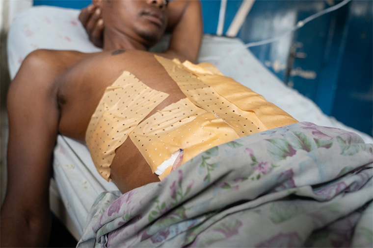 MSFが支援する北キブ州マシシ総合病院の術後ケア病棟で、銃創を負った男性が休む=2025年9月3日　Ⓒ Sam Bradpiece/MSF